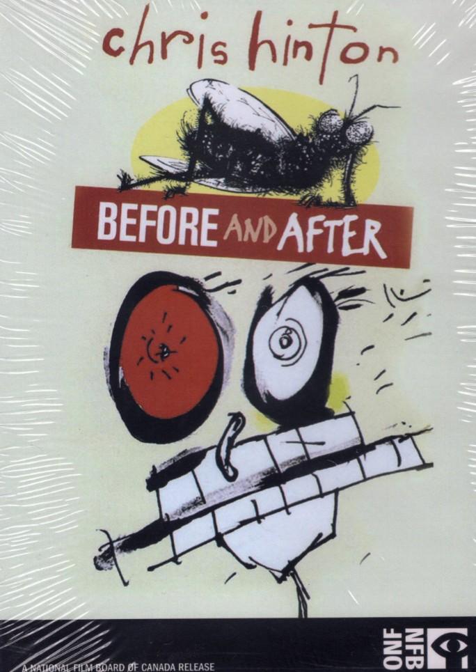 Chris Hinton / Before and After - DVD
