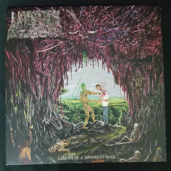 Undeath / Lesions Of A Different Kind - LP green